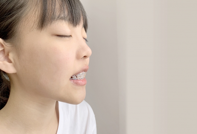 当院の成人矯正