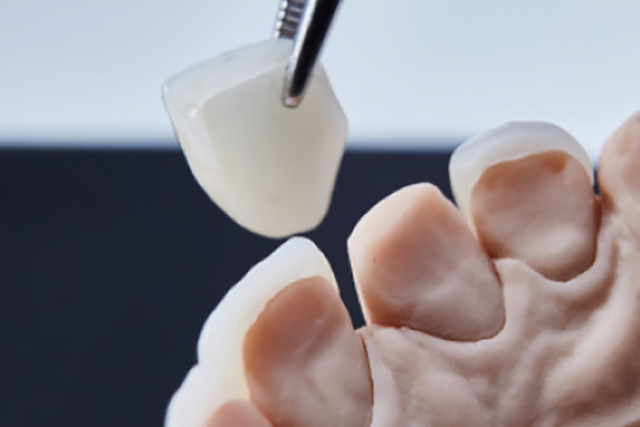 かぶせ物（補綴）