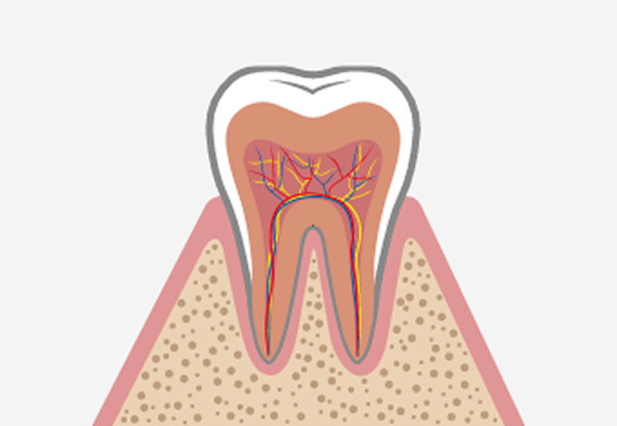 初期歯周病（軽度）